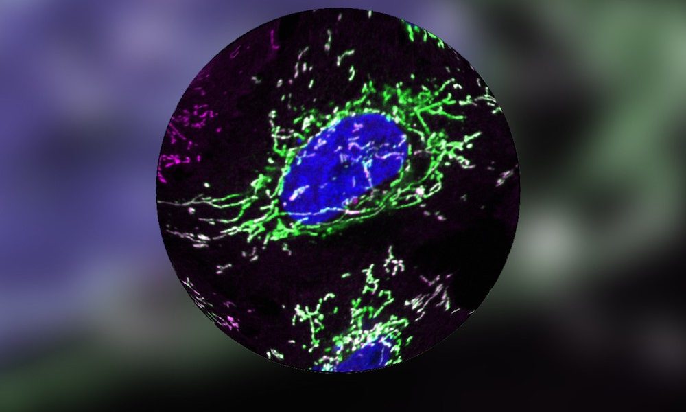 Stress study advances understanding of ageing cells