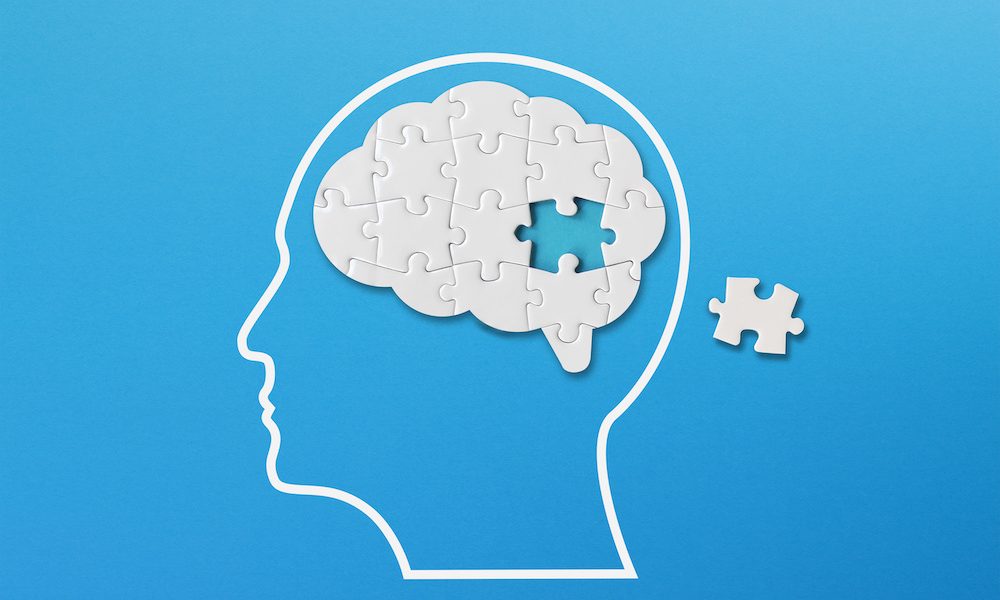 Genetics and brain MRI combined could help predict Alzheimer’s