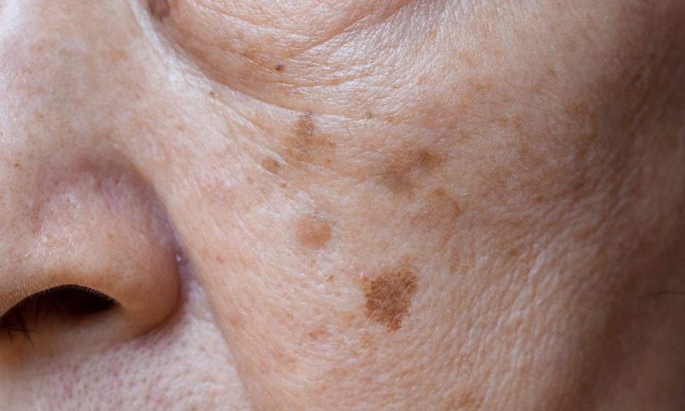 Taurine found to promote anti-ageing