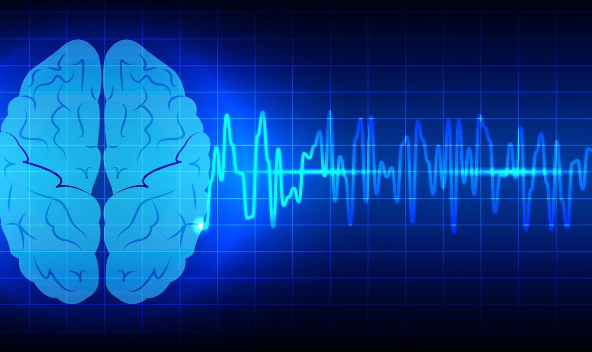 FDA gives go ahead to Neurosteer brain monitoring platform