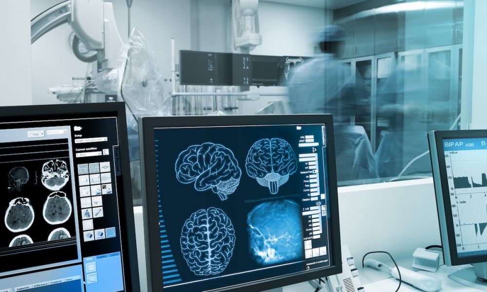 $21 million NIA grant to fund study of novel dementia treatment