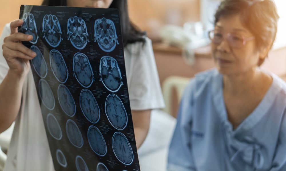 Interview: Quibim raises US$50m to accelerate precision medicine with AI imaging biomarkers