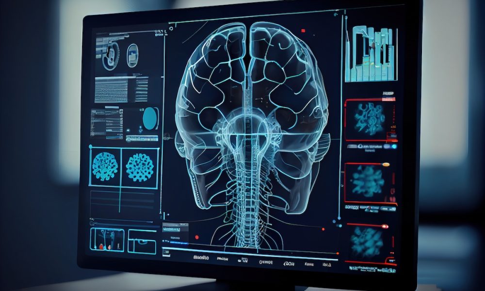 New focused ultrasound effective for treating Parkinson’s – study