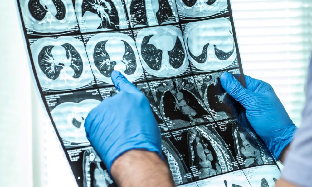 Groundbreaking new approach to Alzheimer’s diagnosis and treatment