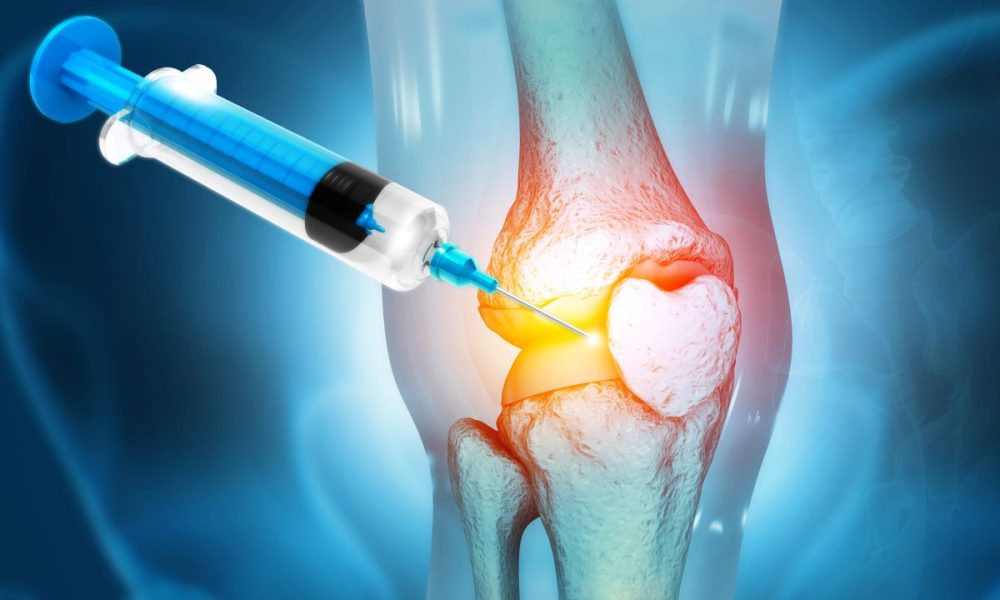 Injectable osteoarthritis treatment shows positive safety results