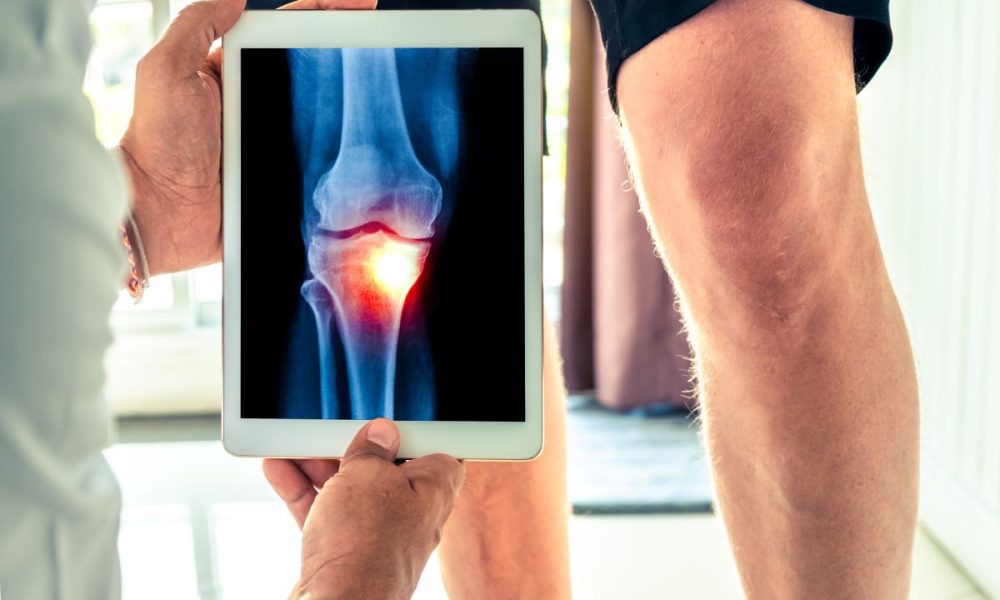 Animal drug could be repurposed to help osteoarthritis sufferers