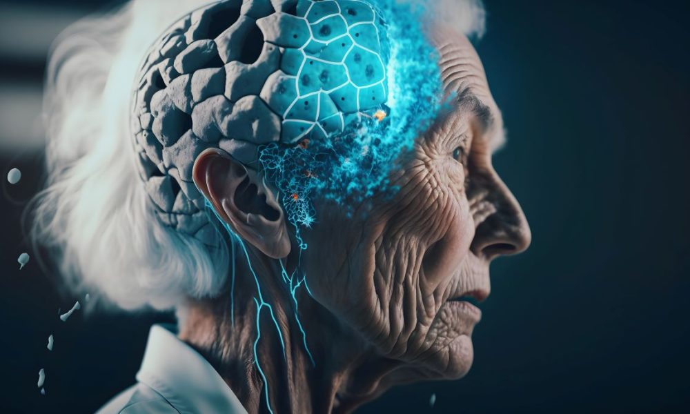 Alzheimer’s expert on bridging the gap between ‘bench’ research and the community