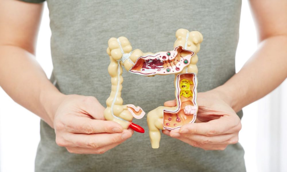New study highlights link between IBD and increased risk of stroke
