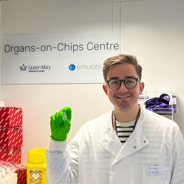 Model of human synovium could accelerate treatments for arthritis