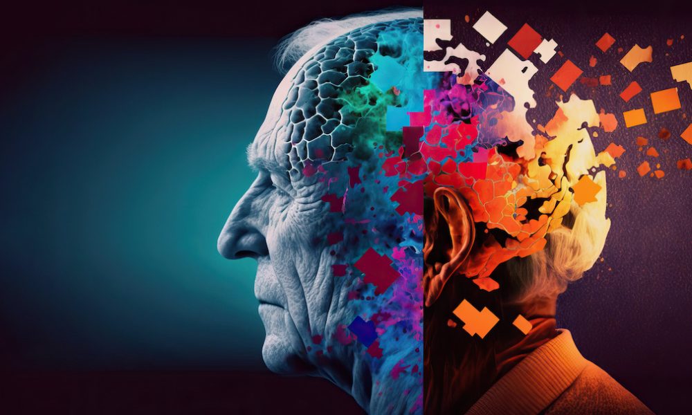 Risk of dementia nearly three times higher after stroke – study