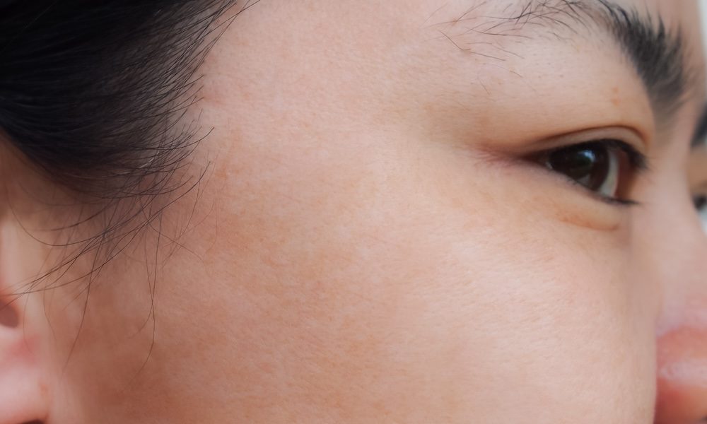 Boost for landmark skin ageing research
