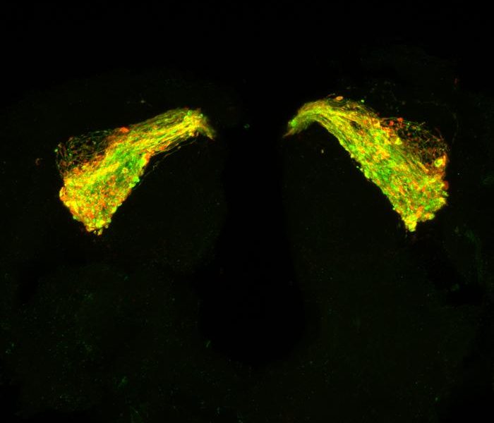 Promising ‘first’ in Alzheimer’s drug development