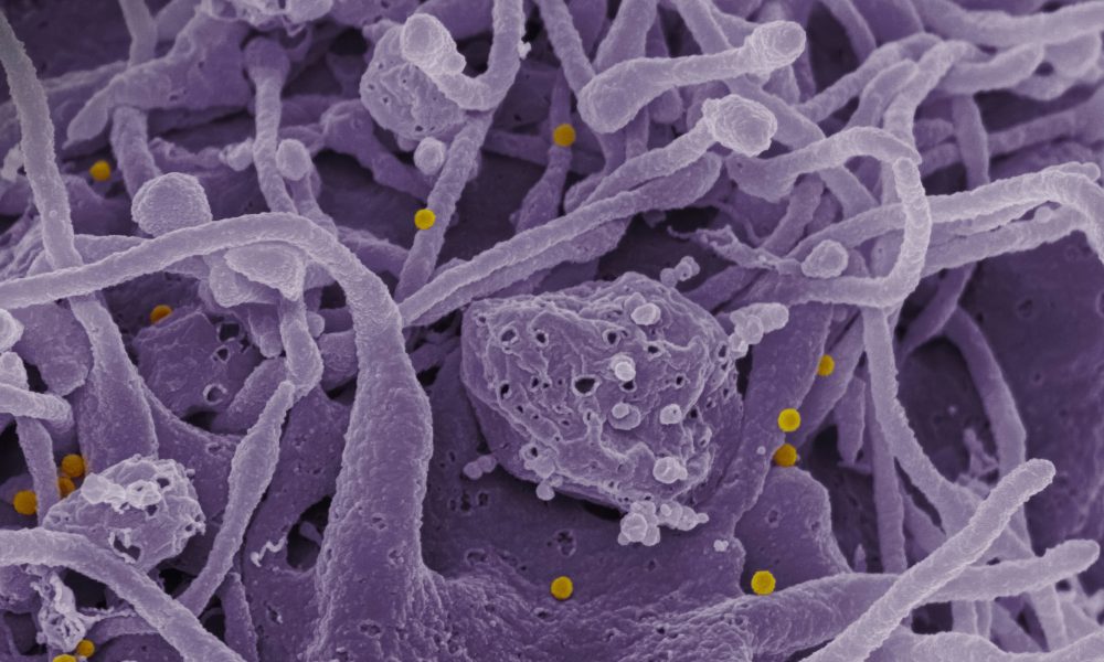 Gut microbiome of world’s oldest woman may reveal secrets to longevity