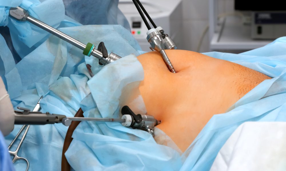 Weight stigma, not BMI, has biggest impact on mental health after weight-loss surgery