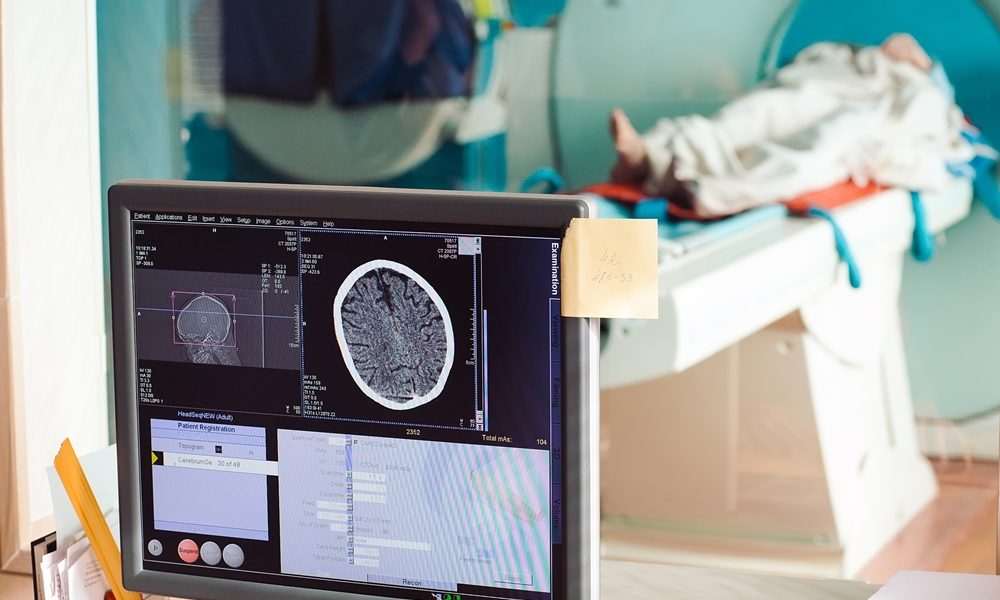 Brain scan tool shows how fast you’re ageing