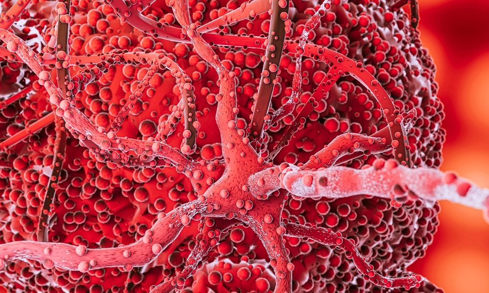 Microglia discovery offers clues to Alzheimer’s progression