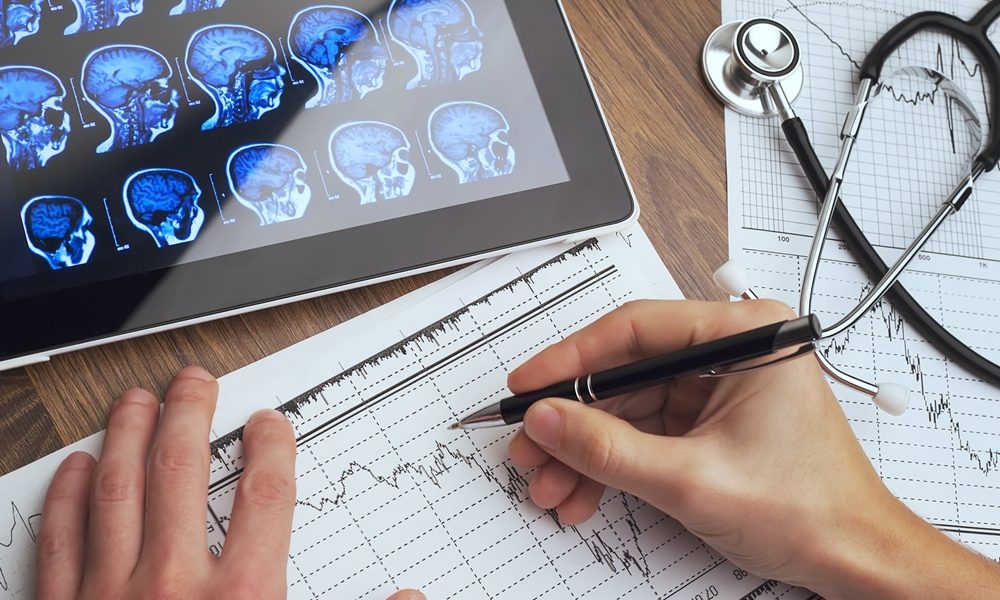 Test predicts dementia risk years earlier