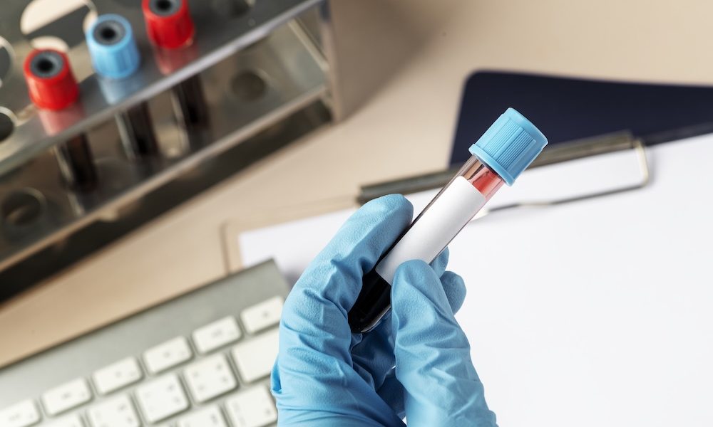 Blood test could spot pancreatic cancer earlier