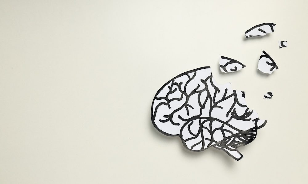 AI system could help identify Alzheimer’s earlier