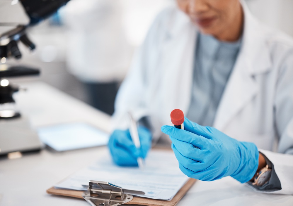 Alzheimer’s blood test could detect symptoms years before diagnosis