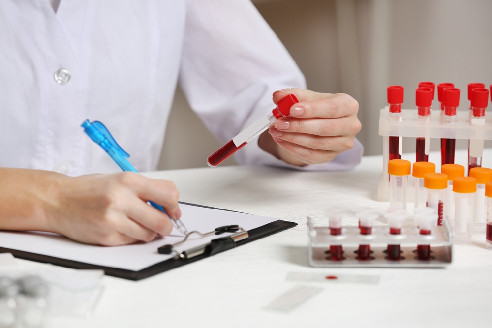 AI-powered blood test identifies four dementia-linked brain diseases with 92.3% accuracy